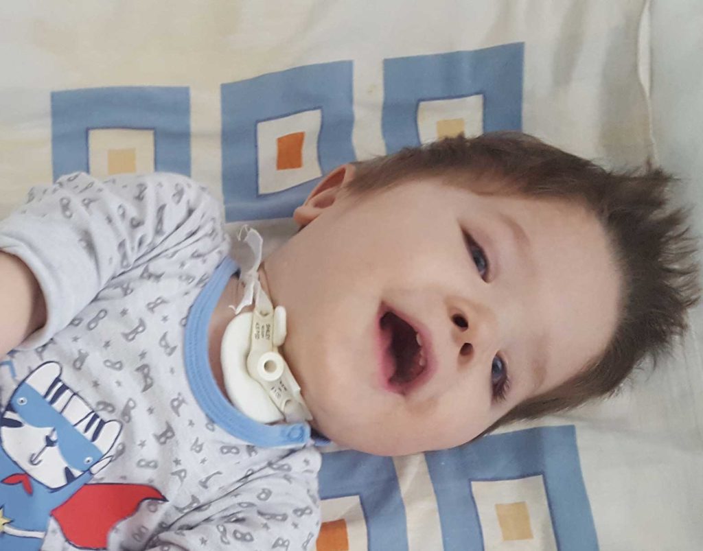 Cea mai scurtă internare